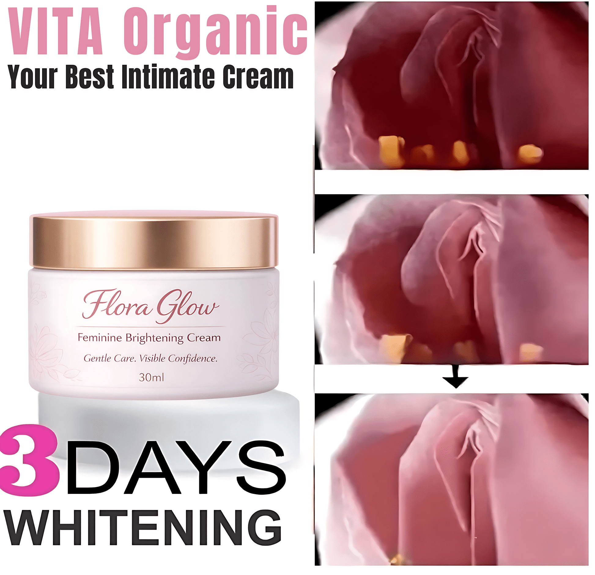 Flora Glow Private Parts Brightening Cream - Vita Organics
