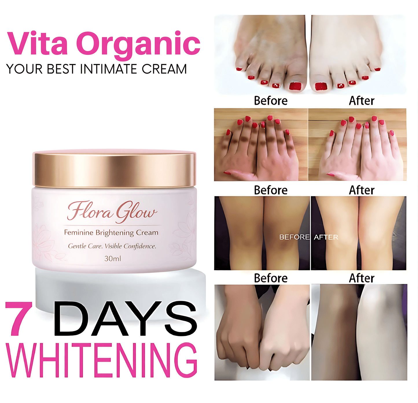 Flora Glow Private Parts Brightening Cream - Vita Organics
